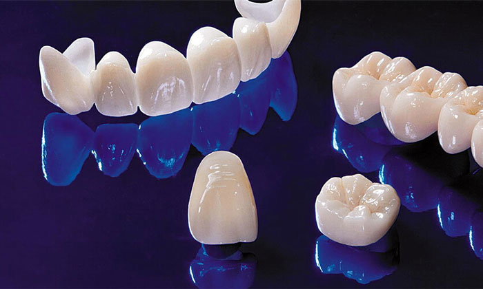 Sứ E.max và sứ Zirconia: Nên chọn loại nào?